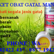 Illustration for article titled obat kadas alami
